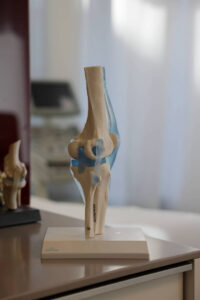 Modell-Knie_Foto-Orthopaedie-Marianowicz-Zentrum-knee-model-cultureandcream-blogpost